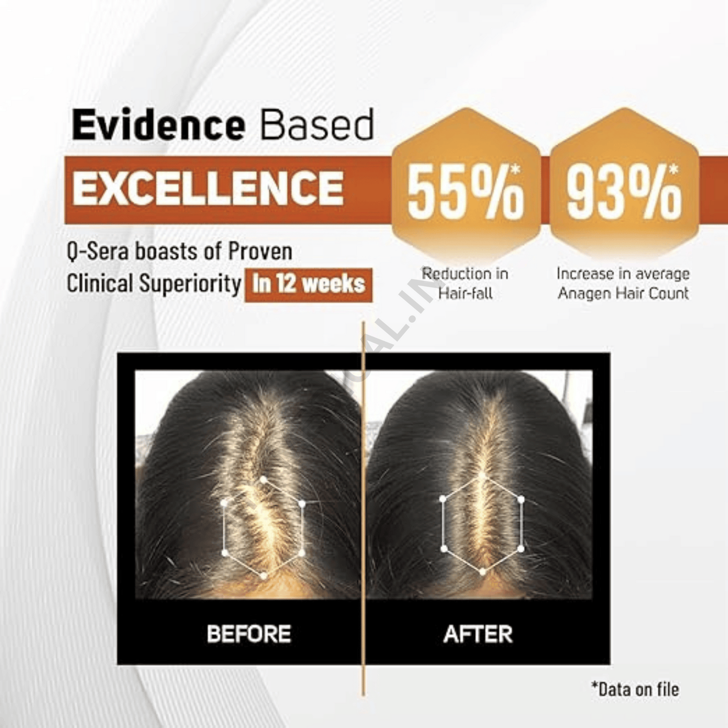 Q Sera Hair Serum, 60ml